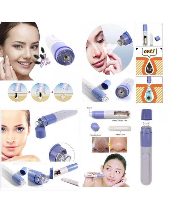 Siyah Nokta Temizleme - Yüz Temizleme Cihazı Vakumlu Siyah Nokta Temizleme Cihazı