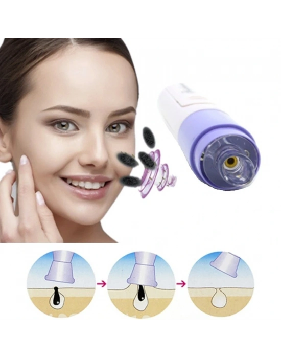 Siyah Nokta Temizleme - Yüz Temizleme Cihazı Vakumlu Siyah Nokta Temizleme Cihazı