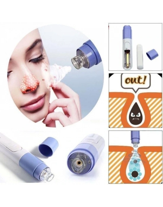 Siyah Nokta Temizleme - Yüz Temizleme Cihazı Vakumlu Siyah Nokta Temizleme Cihazı