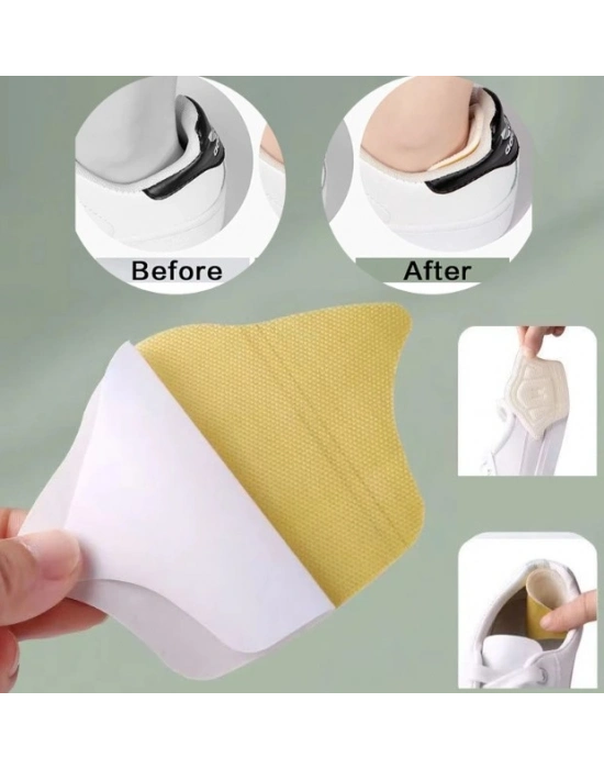 Taç Şeklinde Topuk Vurma Önleyici 10 mm.