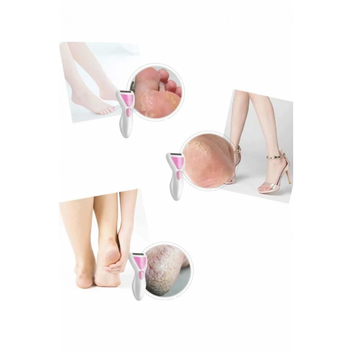 BFS Epilatör Cihazı Epilasyon Aleti Çoklu Başlık Seçeneği Ayak Törpüsü