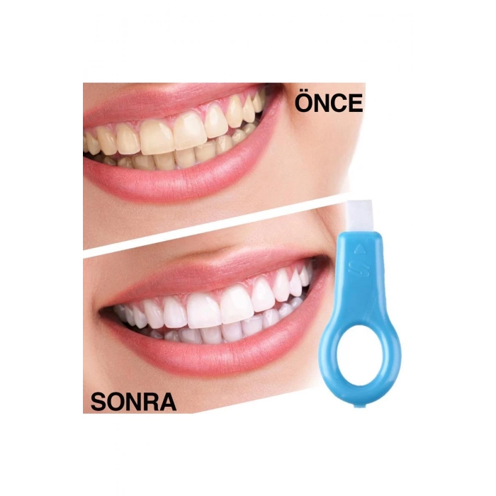 ÇOK SATAN 6 Paket Etkili Ağız Bakımı Jel Diş Beyazlatıcı Leke Giderici