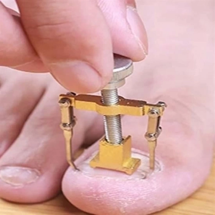 ÇOK SATAN Batan Tırnak Düzeltme Aleti Batık Tırnak Çıkarıcı Aparat