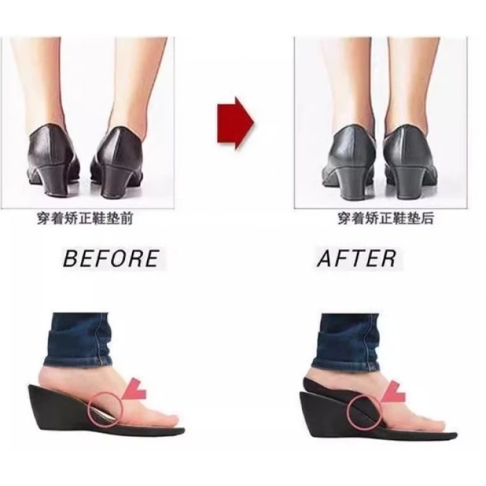 ÇOK SATAN Esnek Düz Taban Düzeltici Topuk Yastığı