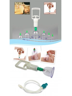 Hacamat Seti Hortumlu - Vakumlu Hortumlu Kupa Çekme Seti (model 2)