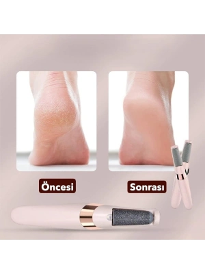 Şarjlı Ayak Törpüsü - Pedikür ve Ayak Bakım Aleti