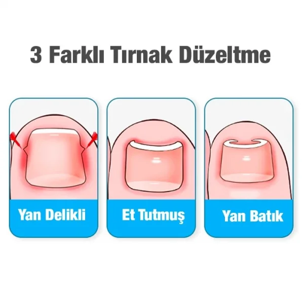 Ezere 24 Parça Profesyonel Tırnak Bakım ve Onarım Manikür Pedikür Seti-(5775)