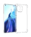 Xiaomi Mi 11 Lite Kamera Korumalı Shockproof Şeffaf Silikon Kılıf-(5775)