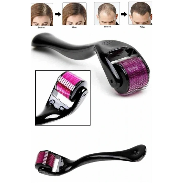 LitaeTrend Derma Roller Titanyum Uçlu 540 İğneli 1 Mm Saç Sakal Çıkarma Ve Cilt Bakım Masaj Aleti