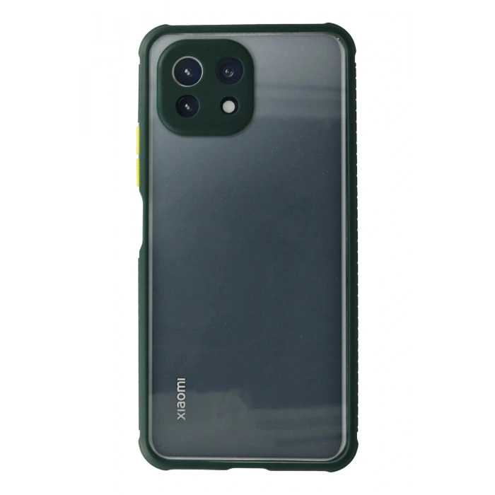 LitaeTrend Xiaomi Mİ 11 Lite Kılıf Miami Şeffaf Silikon - Koyu Yeşil