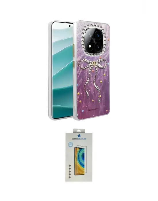 ieg™ Redmi Note 14 Pro 4G Kılıf Zirve Modern Prime - Şeffaf Polymer Nano Ekran Koruyucu