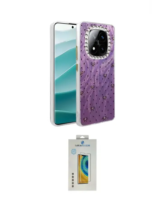 ieg™ Redmi Note 14 Pro 4G Kılıf Zirve Modern Prime - Şeffaf Polymer Nano Ekran Koruyucu
