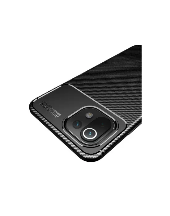 Xiaomi Mi 11 Lite Kılıf Auto Focus Karbon Kapak - Siyah