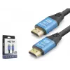 Hdmi 2.0 Kablo 4K Uhd 19+1 Od 8.0 Mm 1.5 M - Siyah Mavi ND4050