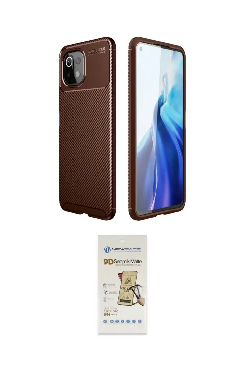 ieg™ Mİ 11 Lite Kılıf Eksen Form Prime - Siyah Mat Seramik Nano Ekran Koruyucu
