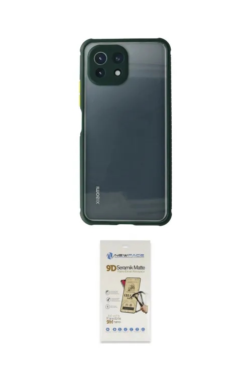 ieg™ Mİ 11 Lite Kılıf Nova Asil Özel Seri - Siyah Mat Seramik Nano Ekran Koruyucu