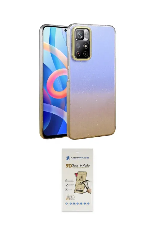 ieg™ Redmi Note 11 Pro Kılıf Kıvılcım Minimal Özel Seri - Siyah Mat Seramik Nano Ekran Koruyucu