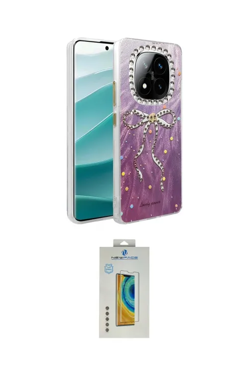 ieg™ Redmi Note 14 Pro 4G Kılıf Zirve Modern Prime - Şeffaf Polymer Nano Ekran Koruyucu