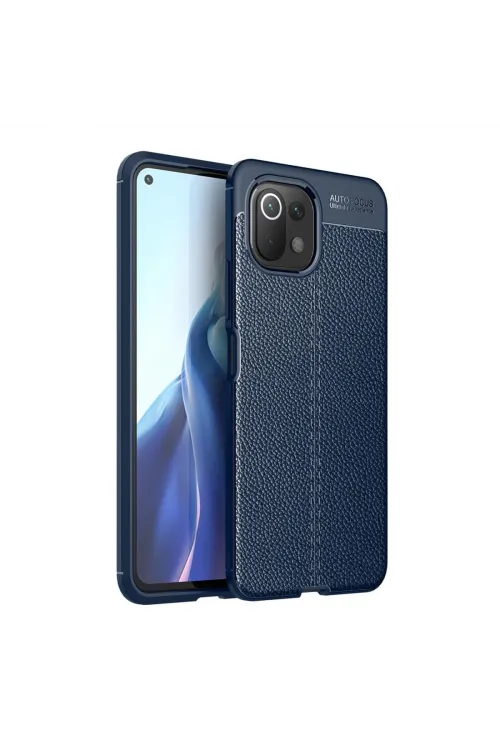 Xiaomi Mi 11 Lite Kılıf Auto Focus Kapak - Lacivert