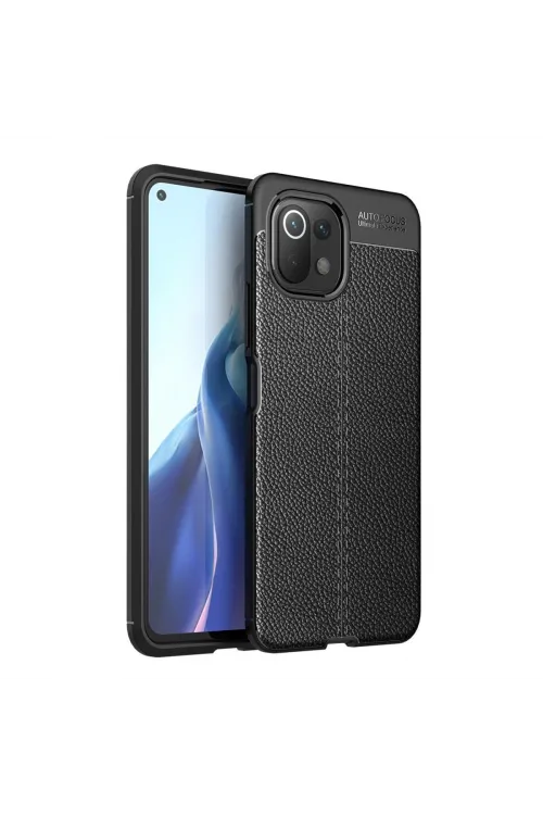 Xiaomi Mi 11 Lite Kılıf Auto Focus Kapak - Siyah