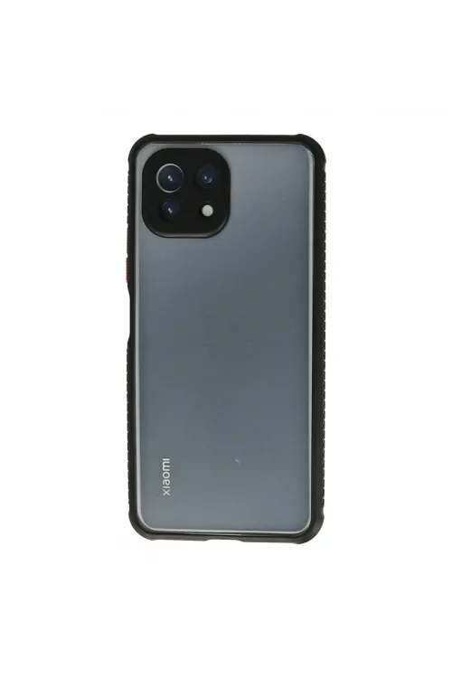 Xiaomi Mi 11 Lite Kılıf Miami Şeffaf Silikon - Siyah