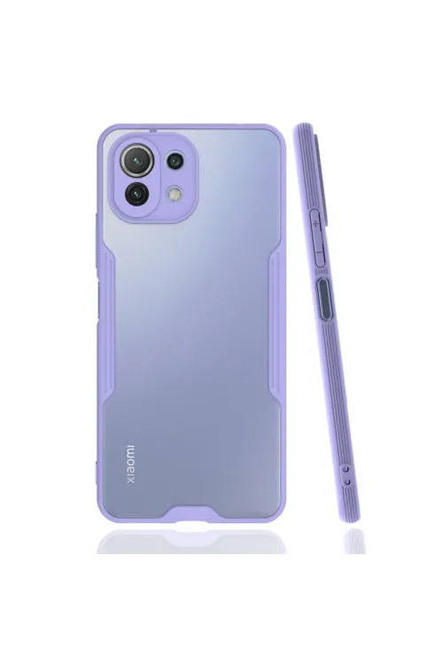 Xiaomi Mi 11 Lite Kılıf Platin Silikon - Lila