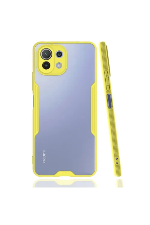 Xiaomi Mi 11 Lite Kılıf Platin Silikon - Sarı