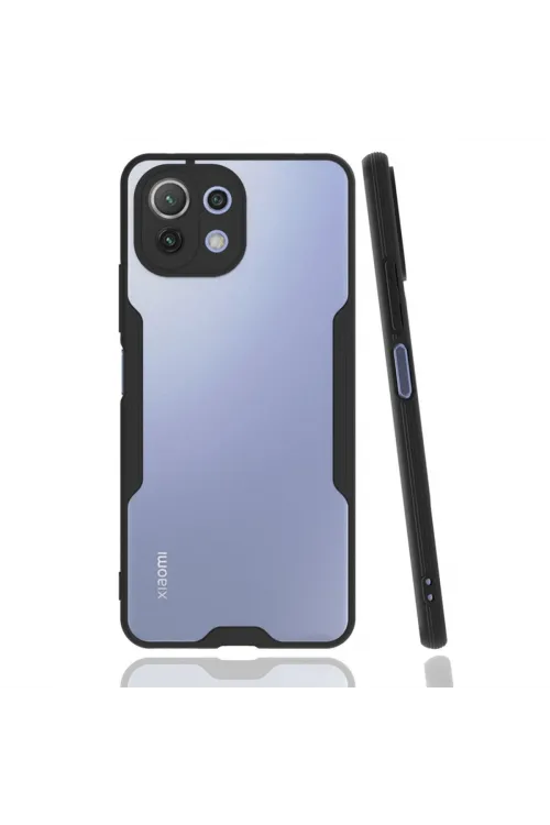 Xiaomi Mi 11 Lite Kılıf Platin Silikon - Siyah