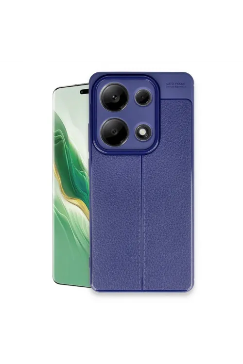 Xiaomi Redmi Note 13 Pro 4g Kılıf Auto Focus Kapak - Lacivert