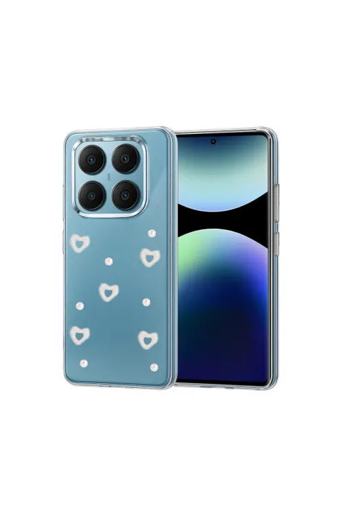 Xiaomi Redmi Note 14 Pro 4g Fiyonk Desenli Kapak - Desen 10