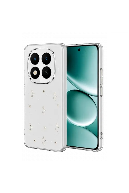 Xiaomi Redmi Note 15 Pro Plus 5g Fiyonk Desenli Kapak - Desen 4