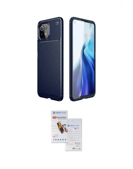 ieg™ Mİ 11 Lite Kılıf Eksen Form Prime - Siyah Seramik Nano Ekran Koruyucu