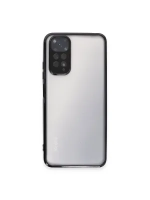 Xiaomi Redmi Note 11 Kılıf Razer Lensli Silikon - Siyah