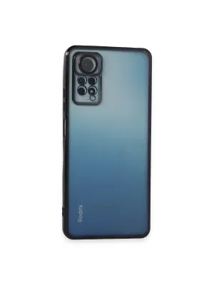Xiaomi Redmi Note 11 Pro Kılıf Razer Lensli Silikon - Siyah