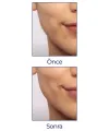 Flawless Yüz Tüy Temizleyici Şarjlı Epilasyon Aleti