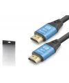 Hdmi 2.0 Kablo 4K Uhd 19+1 Od 8.0 Mm 3 M - Siyah Mavi ND4051