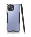 Xiaomi Mi 11 Lite Kılıf Platin Silikon - Siyah