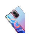 Xiaomi Poco X7 Pro Glossy Kapak - Pembe