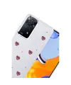 Xiaomi Redmi Note 11 Pro Fiyonk Desenli Kapak - Desen 3