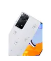 Xiaomi Redmi Note 11 Pro Fiyonk Desenli Kapak - Desen 5