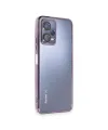 Xiaomi Redmi Note 12 5G Kılıf Razer Lensli Silikon - Mor