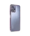 Xiaomi Redmi Note 12 5g Kılıf Razer Lensli Silikon - Mor