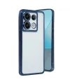 Xiaomi Redmi Note 13 Pro 4g Kılıf Razer Lensli Silikon - Lacivert