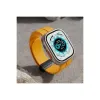 Apple Watch 38mm Kr412 Elegance Stylısh Kordon (saat Değildir) - Siyah
