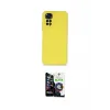 ieg™ Redmi Note 11 Kılıf Ahenk Serisi - Şeffaf Temperli Cam Ekran Koruyucu