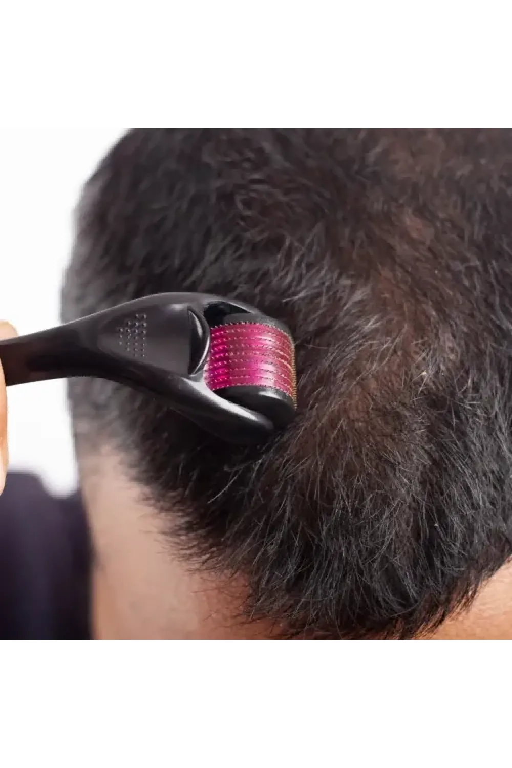 Derma Roller 0.5 mm Titanyum İğneli Cilt Bakım Aleti