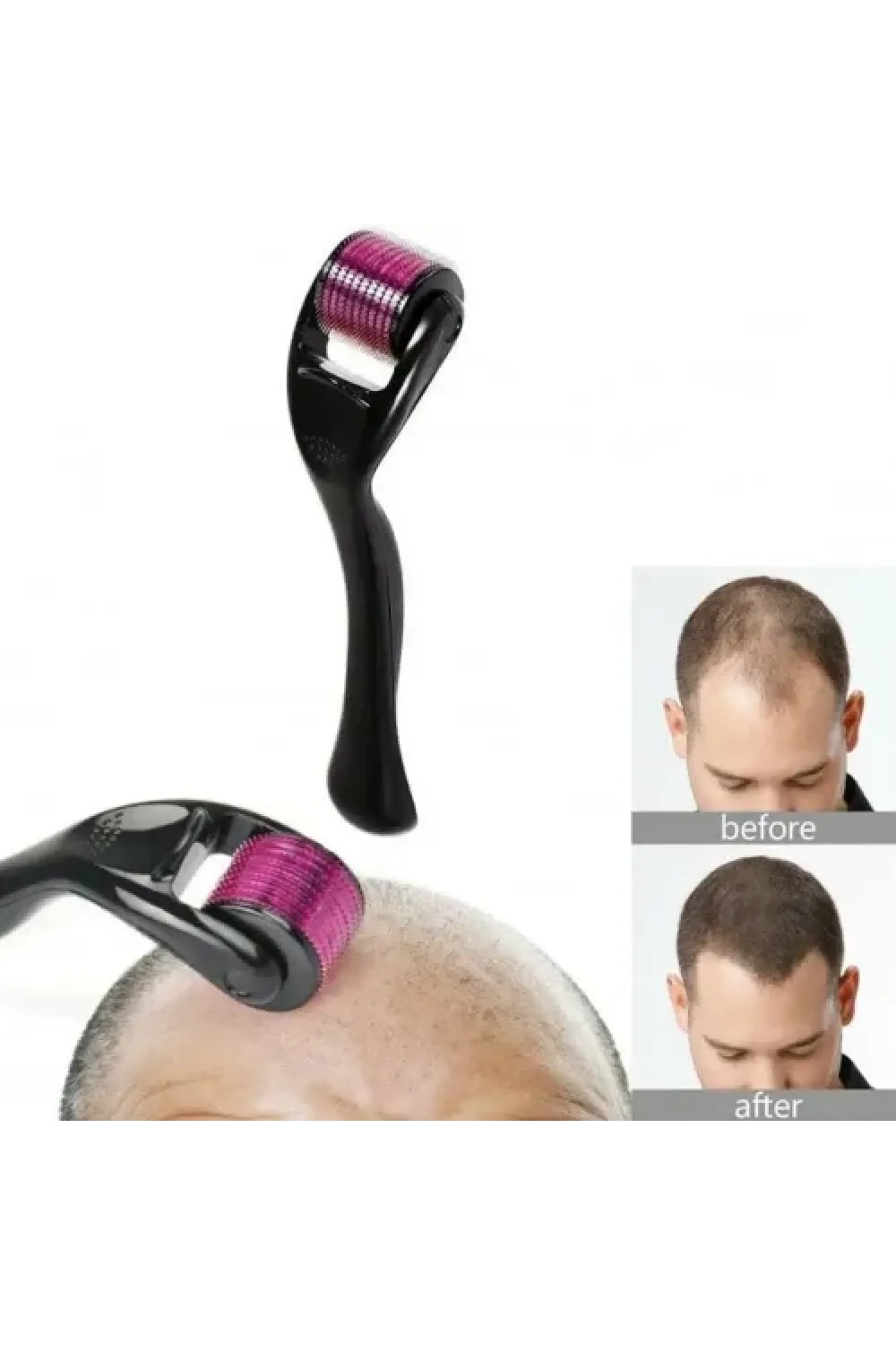 Derma Roller 0.5 mm Titanyum İğneli Cilt Bakım Aleti
