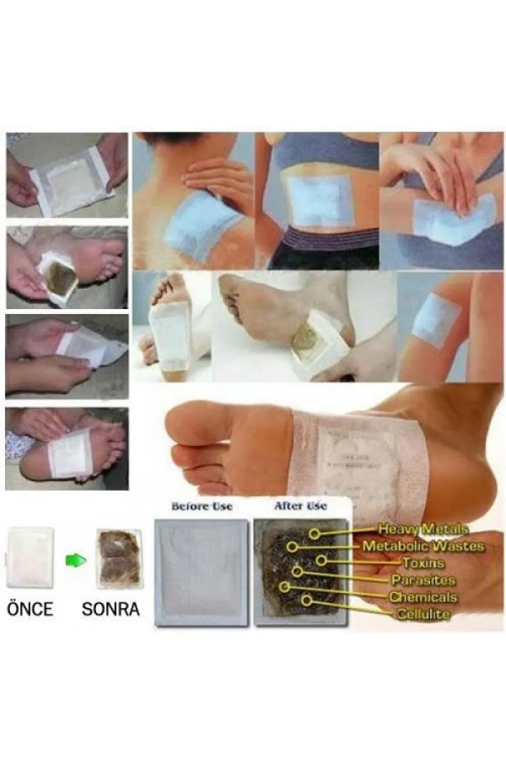 Detox Bandı -Toksin Atıcı 10 Adet