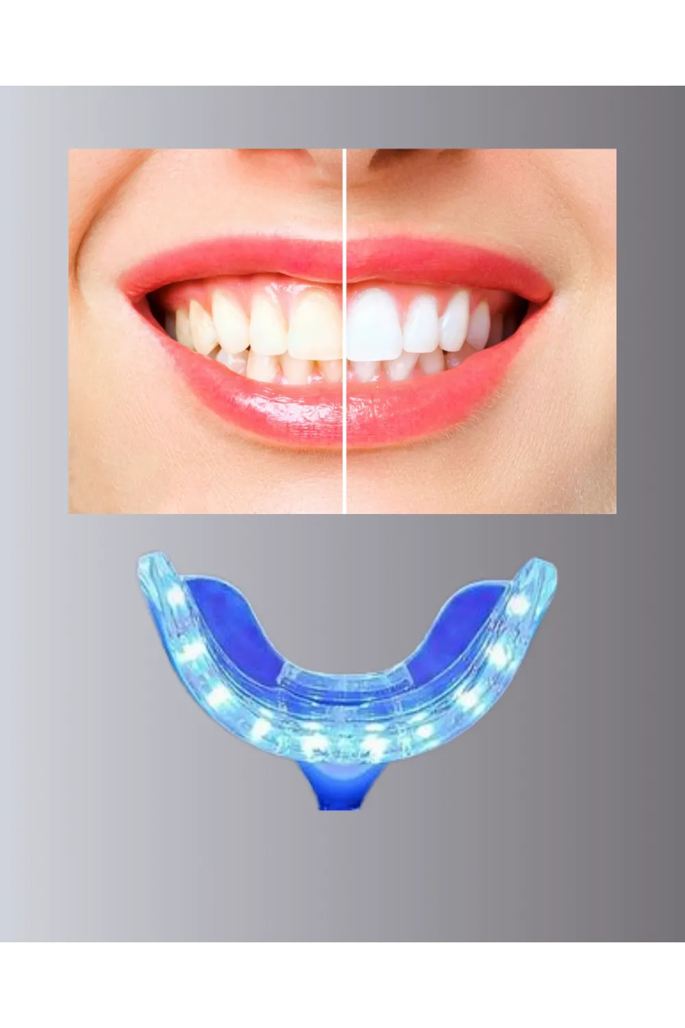 Led Işıklı Profesyonel Diş Beyazlatma Seti