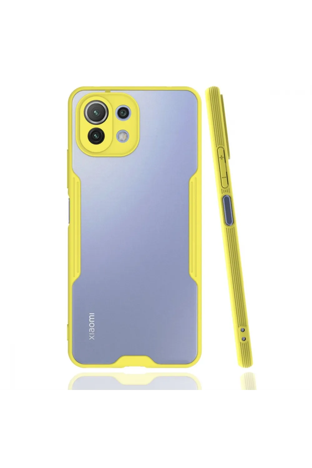 Xiaomi Mi 11 Lite Kılıf Platin Silikon - Sarı